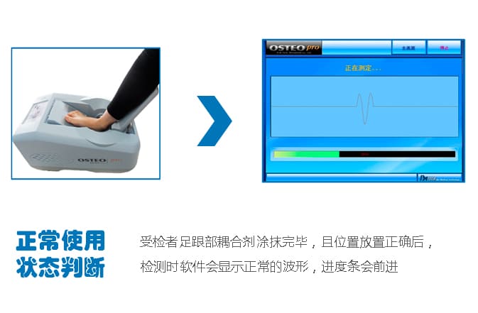 骨密度儀正常判斷_骨密度測定