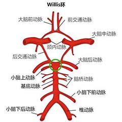 經顱多普勒（TCD）可檢測的顱內動脈大盤點！