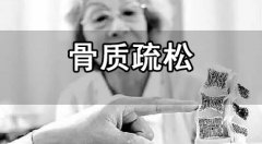 骨密度測(cè)量的時(shí)間和方法介紹