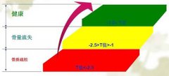 超聲骨密度儀廠家介紹：兩次骨密度檢查結(jié)果如何對(duì)比