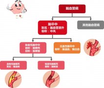 主要的腦血管疾病——腦卒中是如何分類的