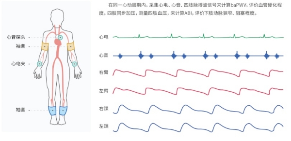 動脈硬化檢測