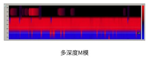 動(dòng)態(tài)M模